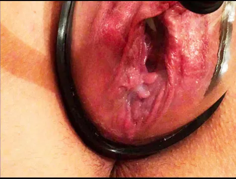 Pompe vaginale